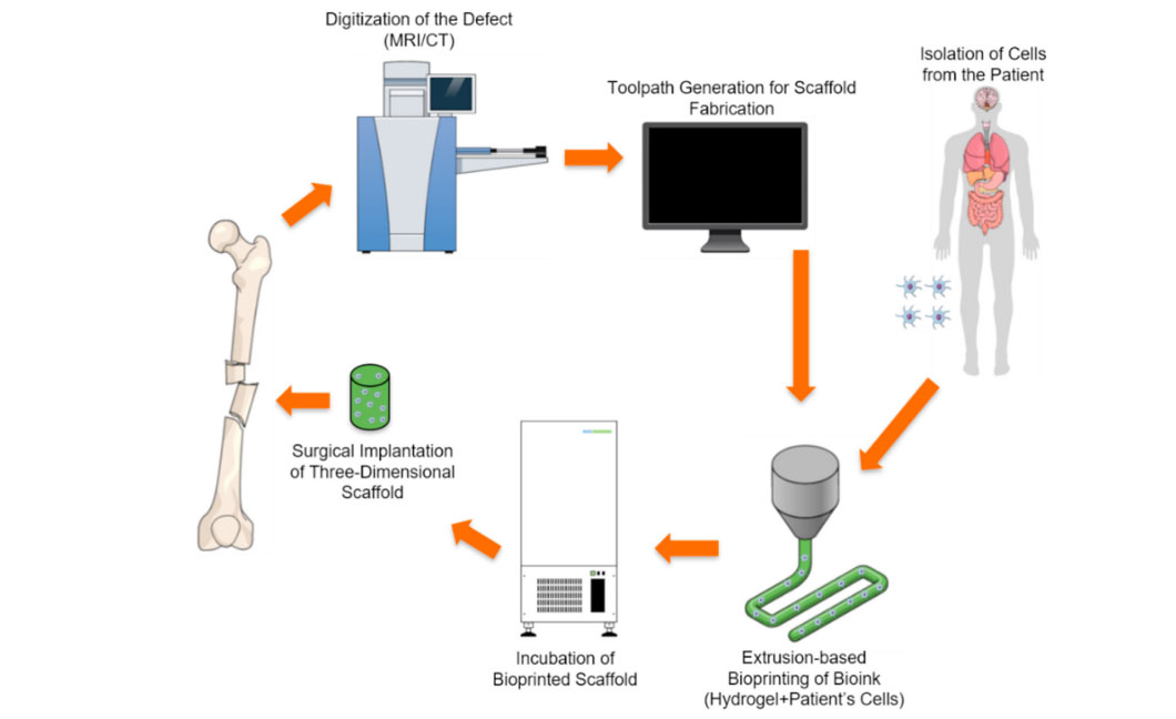 Extrusion bioprinting process illustrating step-by-step creation of 3D-printed scaffolds using patient-derived cells and bioinks for regenerative medicine.