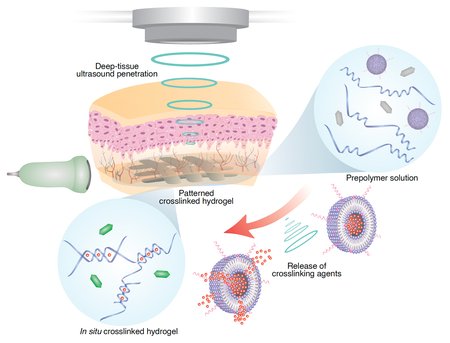 Schematic of Ultrasound in Vivo 3D Bioprinting workflow: deep-tissue ultrasound penetration, liposome release, and in situ hydrogel crosslinking.